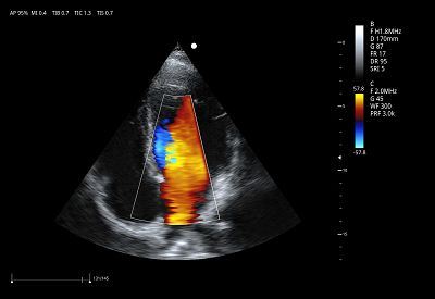 Cardiac C Mode(001)
