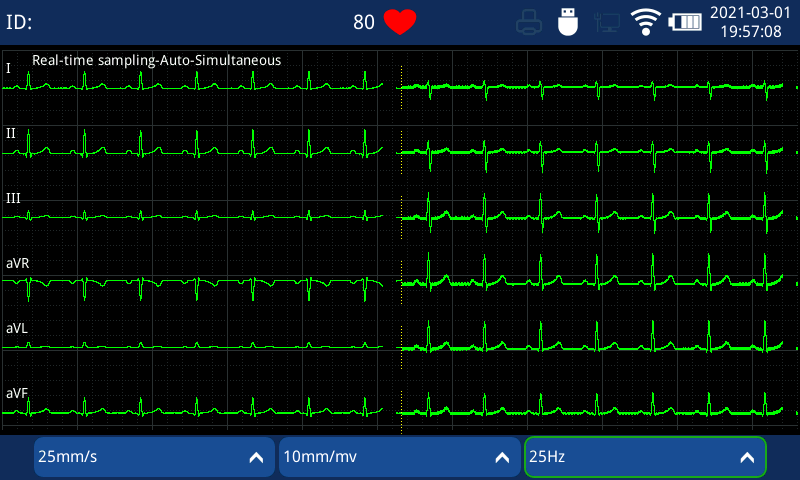 ECG Machine with report preview
