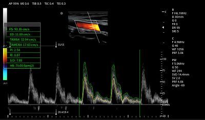 CCA PW Auto trace(001)