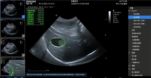 Zoncare Pioneers Abdominal AI For Veterinary Ultrasound in China